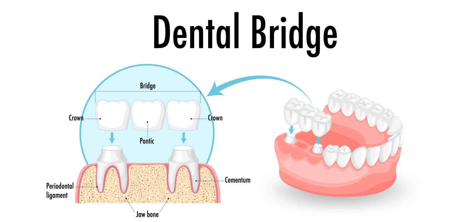 Dental Clinic in Raysan Gandhinagar