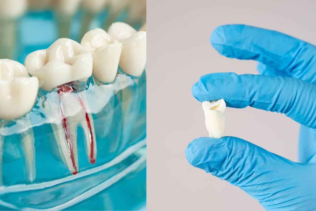 Avoid Extraction Myth