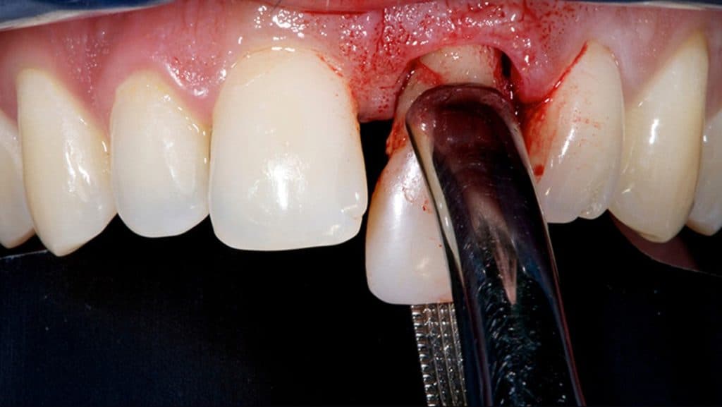 Health Problems Myth