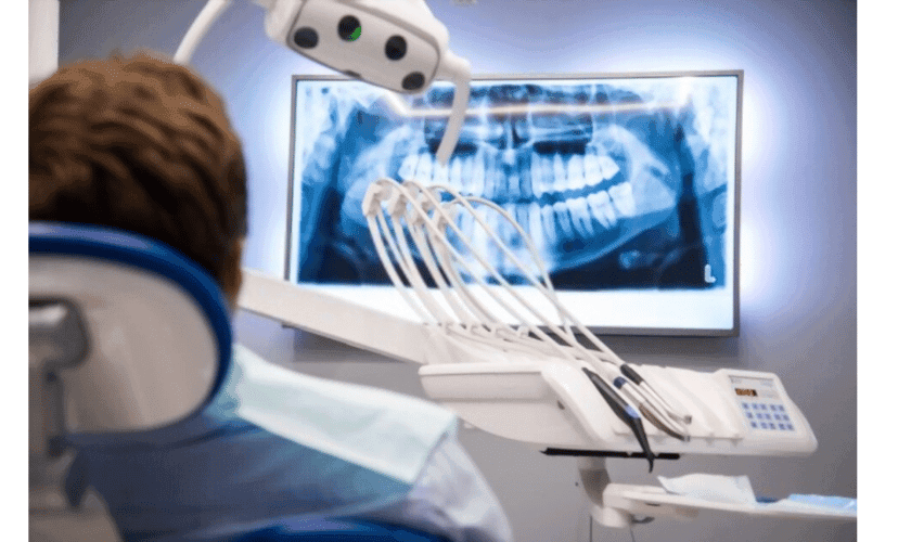 Dental X-Ray Diagram